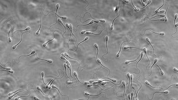 What is Low Sperm Motility? - Ovarium Conception